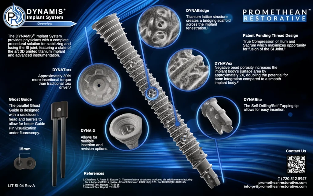 Dynamis Implant System Brochure Thumbnail