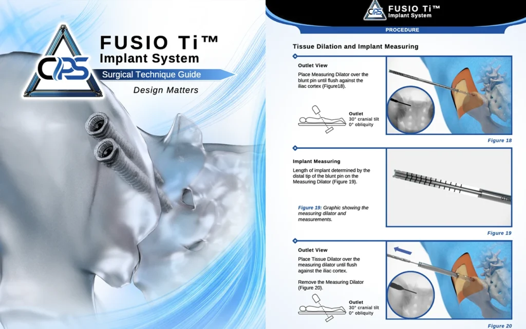 Fusio TI Brochure Thumbnail